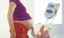 Норма допплерометрии для беременных